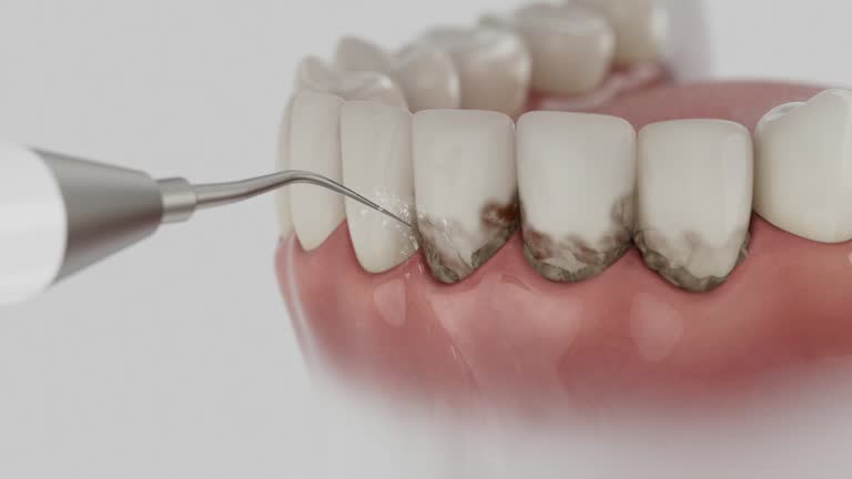 Reliable Emergency Dentist contractor in Terrell, TX by Smile Center Dentistry